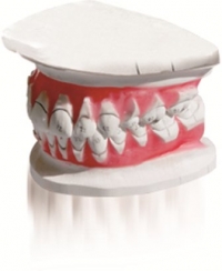 Пациенты часто сталкиваются с проблемой после снятия скоб — белые пятна на зубах. Технология установки брекетов Flash Free решает эту проблему. 